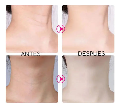MASAJEADOR LED FACIAL | REDUCTOR PAPADA LIFTING ANTIARRUGAS CUELLO